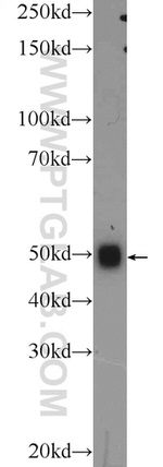 TMEM102 Antibody in Western Blot (WB)
