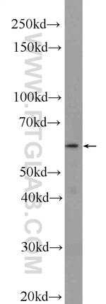 TMEM102 Antibody in Western Blot (WB)