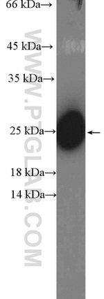 C6orf108 Antibody in Western Blot (WB)