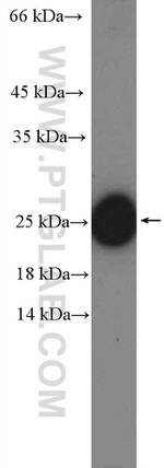 C6orf108 Antibody in Western Blot (WB)