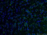 C9orf72 Antibody in Immunohistochemistry (PFA fixed) (IHC (PFA))