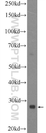 C9orf72 Antibody in Western Blot (WB)