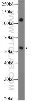 ZNF394 Antibody in Western Blot (WB)