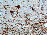 TH Antibody in Immunohistochemistry (Paraffin) (IHC (P))