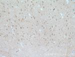 FBXL16 Antibody in Immunohistochemistry (Paraffin) (IHC (P))