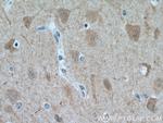 FBXL16 Antibody in Immunohistochemistry (Paraffin) (IHC (P))