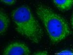 C9orf9 Antibody in Immunocytochemistry (ICC/IF)