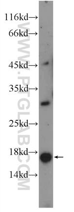 C9orf9 Antibody in Western Blot (WB)