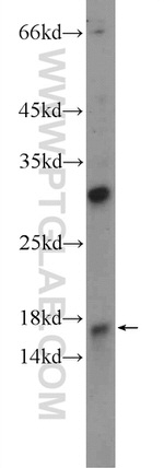 C9orf9 Antibody in Western Blot (WB)