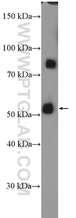 NCAPH2 Antibody in Western Blot (WB)