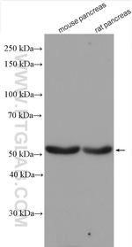 GLP1R Antibody in Western Blot (WB)