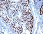 GATA-3 (Center) (Breast and Urothelial Marker) Antibody in Immunohistochemistry (Paraffin) (IHC (P))