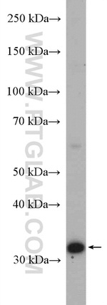 MCU/CCDC109A Antibody in Western Blot (WB)