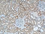 BDKRB1 Antibody in Immunohistochemistry (Paraffin) (IHC (P))