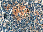 BDKRB1 Antibody in Immunohistochemistry (Paraffin) (IHC (P))