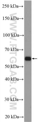 SLC25A12 Antibody in Western Blot (WB)