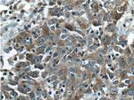 LCN2 Antibody in Immunohistochemistry (Paraffin) (IHC (P))