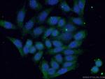 S100A9 Antibody in Immunocytochemistry (ICC/IF)