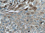 S100A9 Antibody in Immunohistochemistry (Paraffin) (IHC (P))