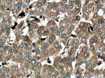 S100A9 Antibody in Immunohistochemistry (Paraffin) (IHC (P))