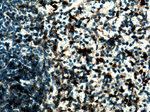 S100A9 Antibody in Immunohistochemistry (Paraffin) (IHC (P))