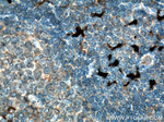 S100A9 Antibody in Immunohistochemistry (Paraffin) (IHC (P))