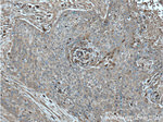 S100A9 Antibody in Immunohistochemistry (Paraffin) (IHC (P))