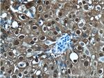 S100A9 Antibody in Immunohistochemistry (Paraffin) (IHC (P))