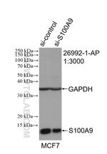 S100A9 Antibody in Western Blot (WB)