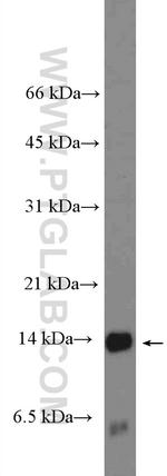 S100A9 Antibody in Western Blot (WB)