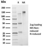 FOXB1 (Transcription Factor) Antibody in SDS-PAGE (SDS-PAGE)
