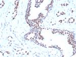 FOXP1 (Transcription Factor) Antibody in Immunohistochemistry (Paraffin) (IHC (P))
