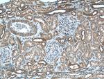 Integrin alpha-6 Antibody in Immunohistochemistry (Paraffin) (IHC (P))