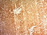 Glypican-3 (GPC3) (Hepatocellular Carcinoma Marker) Antibody in Immunohistochemistry (Paraffin) (IHC (P))