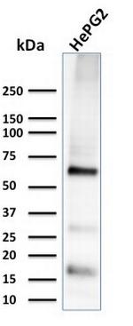 Glypican-3 (GPC3) (Hepatocellular Carcinoma Marker) Antibody in Western Blot (WB)