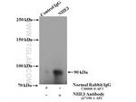 NHE3 Antibody in Immunoprecipitation (IP)