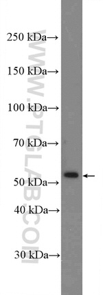 Calreticulin Antibody in Western Blot (WB)