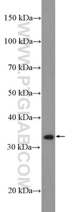 DUSP2 Antibody in Western Blot (WB)