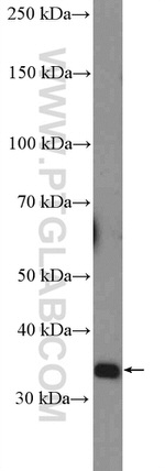 DUSP2 Antibody in Western Blot (WB)