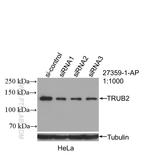 SEMA4A Antibody in Western Blot (WB)