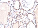 Glyoxalase 1 (GLO1) Antibody in Immunohistochemistry (Paraffin) (IHC (P))