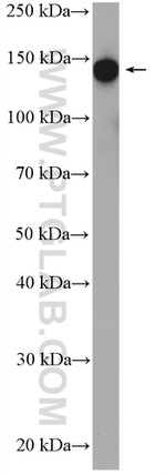 SF3B1 Antibody in Western Blot (WB)