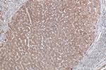 TNC/Tenascin-C Antibody in Immunohistochemistry (Paraffin) (IHC (P))