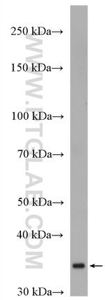 HAPLN2 Antibody in Western Blot (WB)