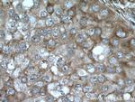 AKAP13 Antibody in Immunohistochemistry (Paraffin) (IHC (P))