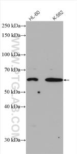 ST6GAL2 Antibody in Western Blot (WB)