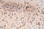 NMDAR2A/GRIN2A Antibody in Immunohistochemistry (Paraffin) (IHC (P))