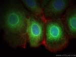 SCD Antibody in Immunocytochemistry (ICC/IF)