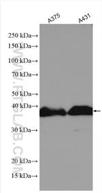 SCD Antibody in Western Blot (WB)