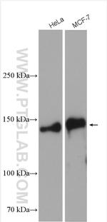 TRPS1 Antibody in Western Blot (WB)